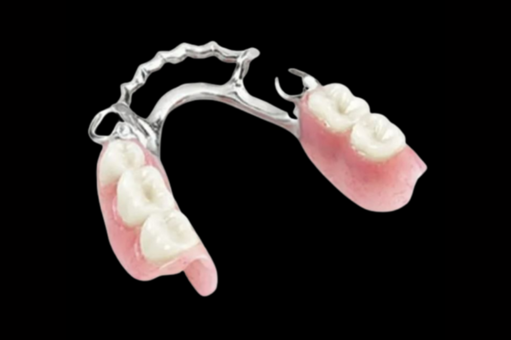 Flexible Partial Dentures Valpast Partials